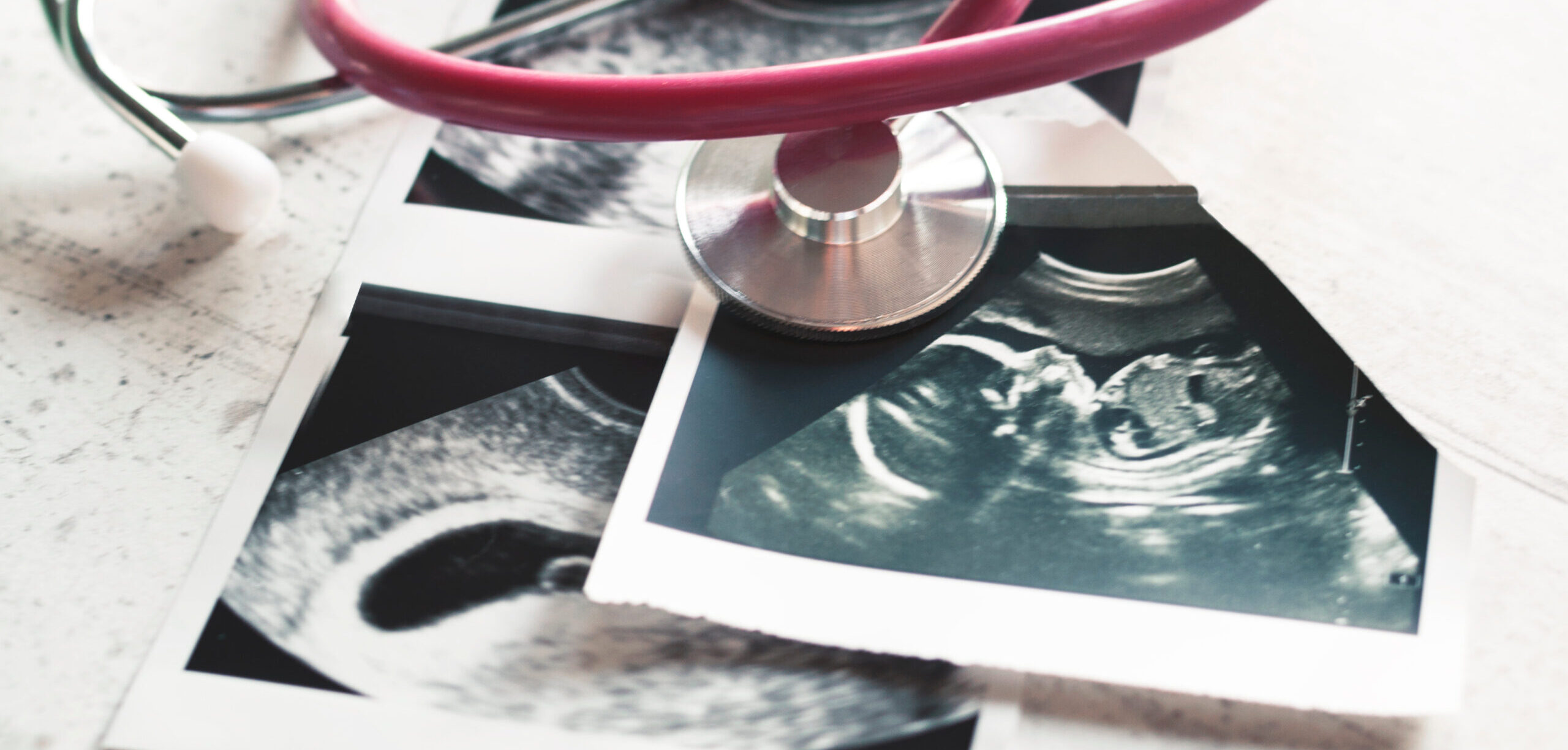 In the pictures of the ultrasound 4 weeks of pregnancy and 20 weeks is a phonendoscope. The concept of the study of pregnancy. Observation Selective focus.