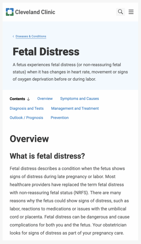 Childbirth medical malpractice