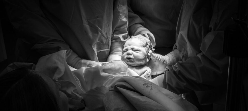 MKR common injuries of birth malpractice