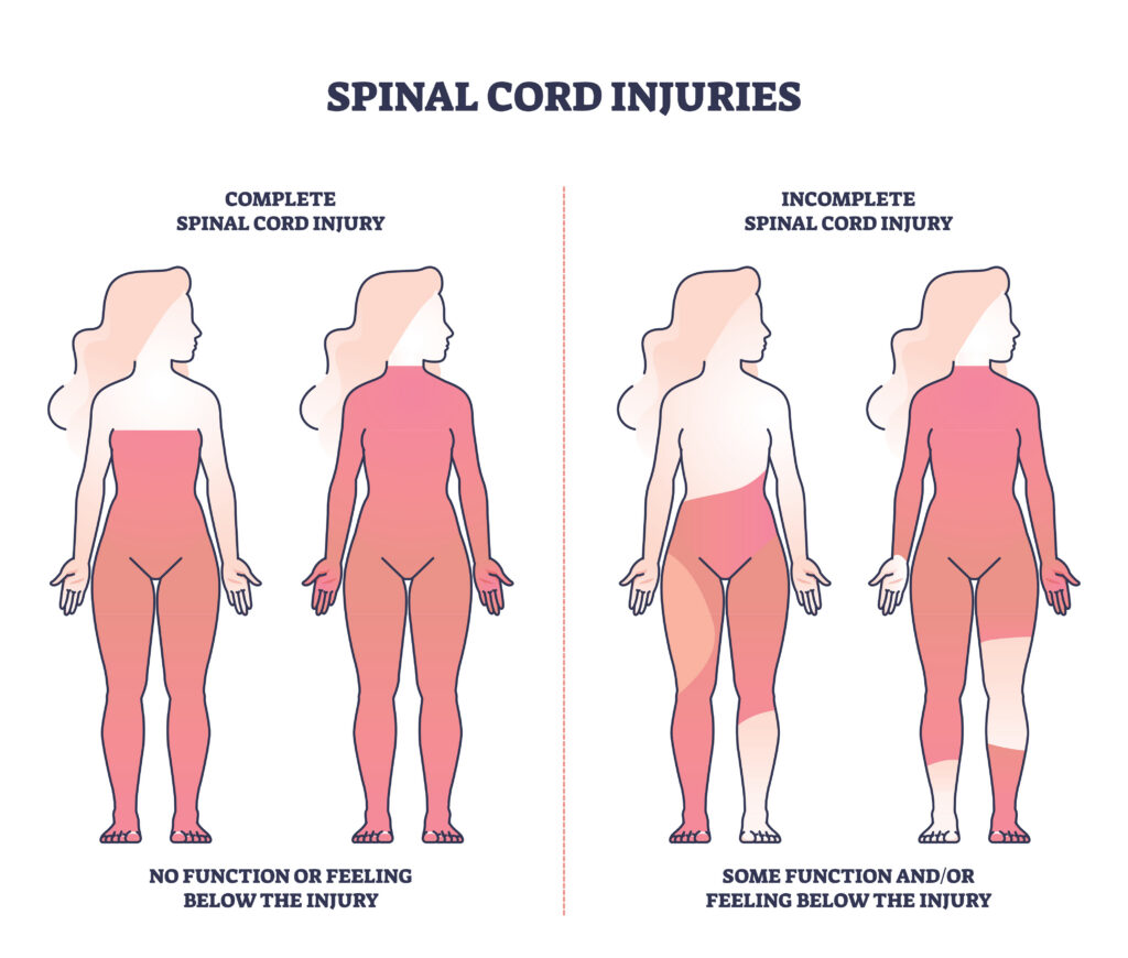 spinal cord injuries